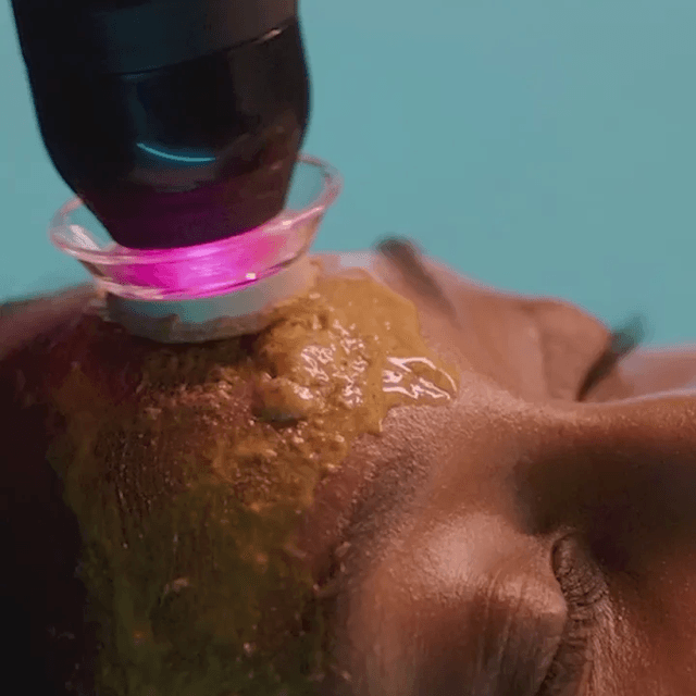 Glo₂ Elite Facial at Esthetics by Lanie in Bassett, NE